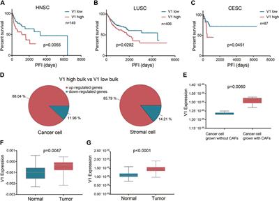 Stromal cell-expressed malignant gene patterns contribute to the progression of squamous cell carcinomas across different sites